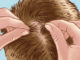 Top 5 simplest natural ways to get rid of head lice eggs and nits